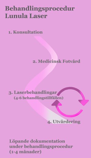 Behandling Lunula Laser Göteborg